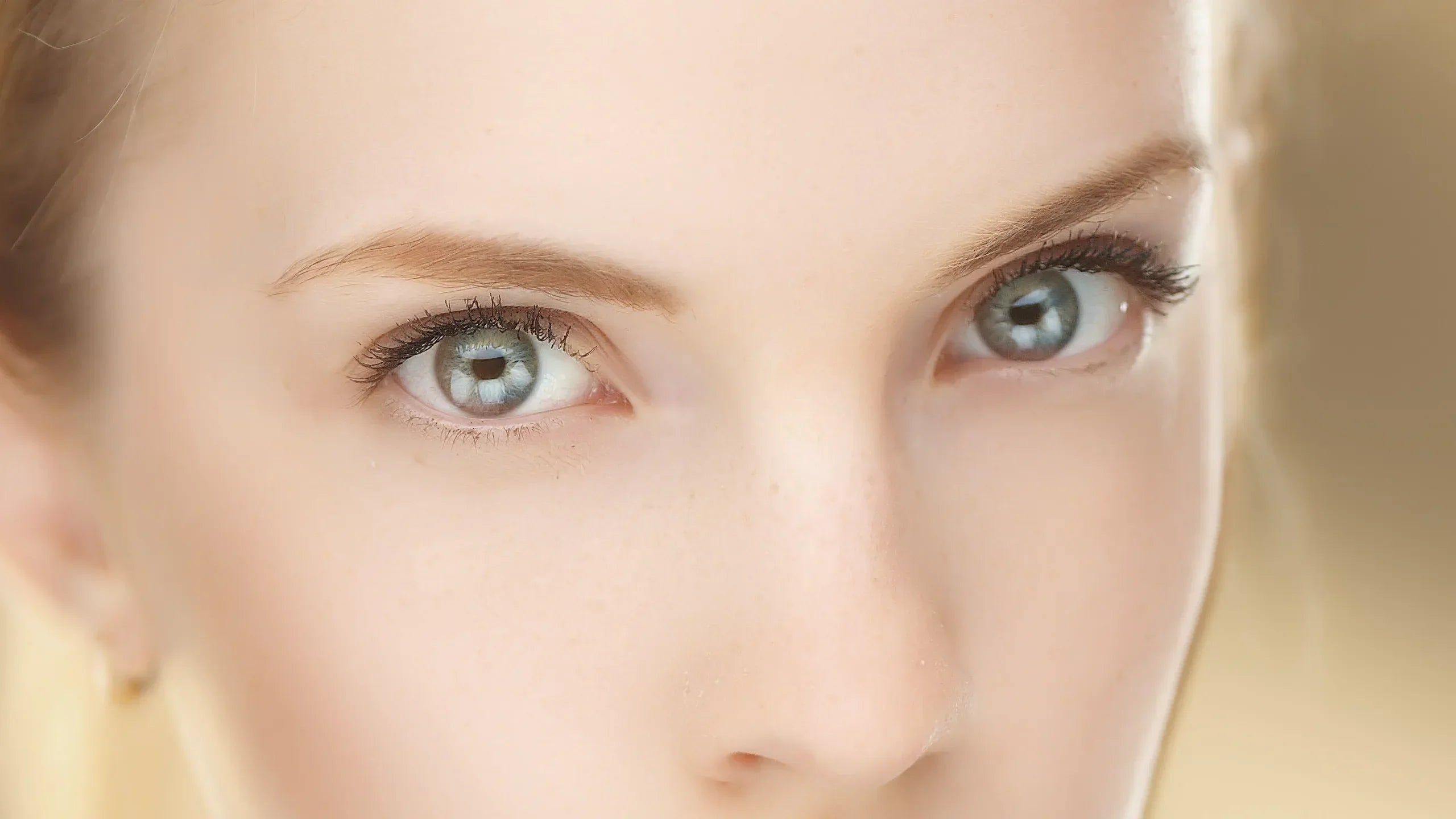 Microneedling Under Eyes