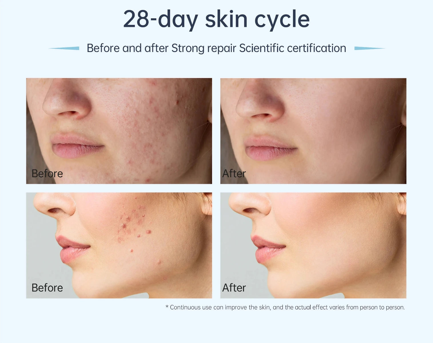 Dr. Pen A11 Microneedling Pen - Dr.Pen Authorized Distributor - Microneedling Pen
