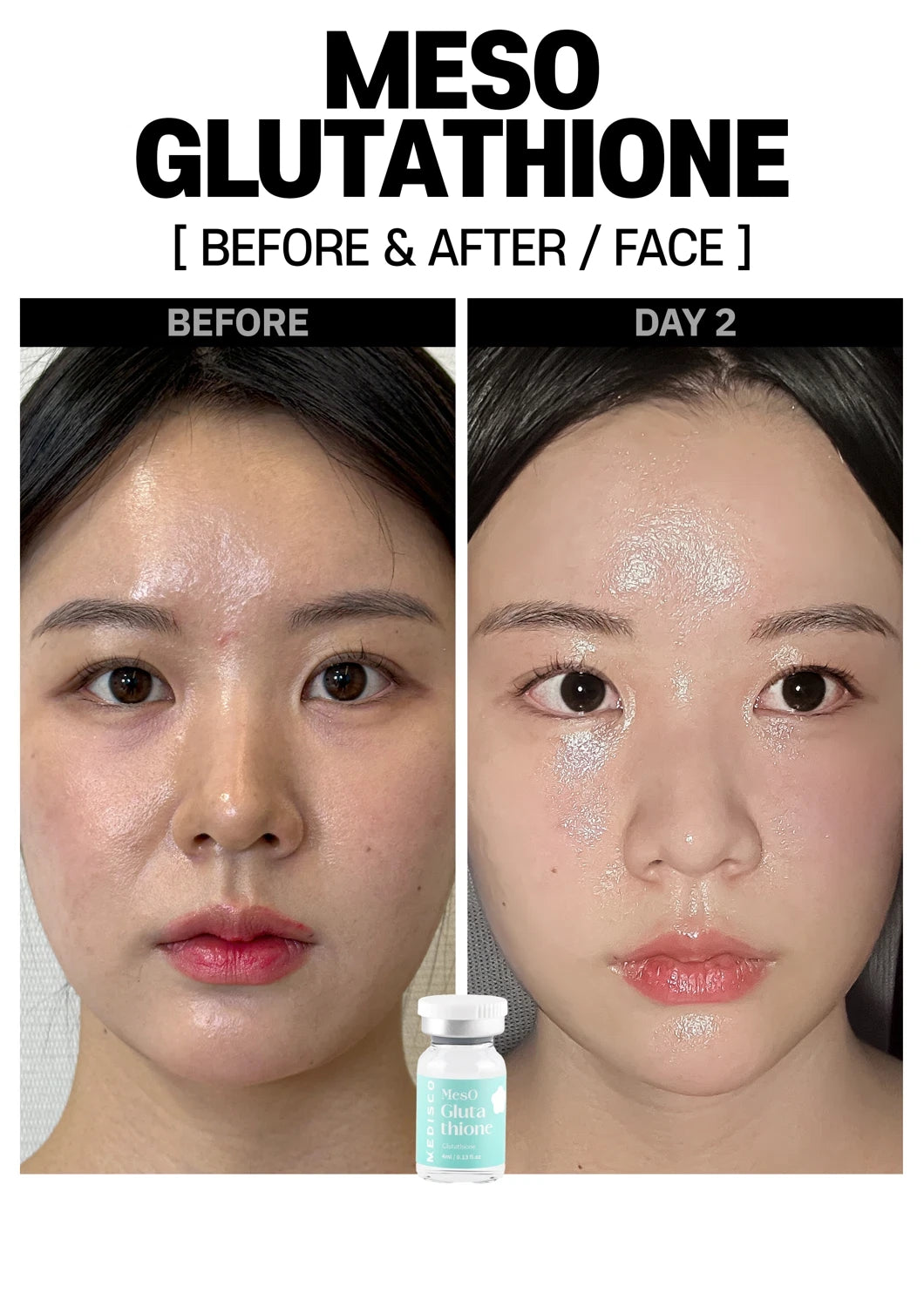 Medisco Meso Glutathione - 5x4ml