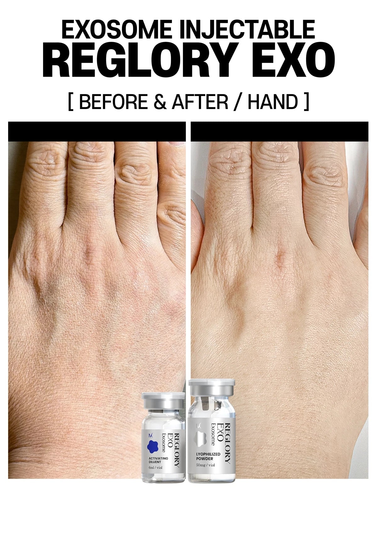Reglory Exo+ (Exosome) - 1x200mg+1x6ml