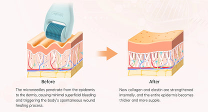 Bio Roller G10 10-in-1 Ultimate Microneedling Kit