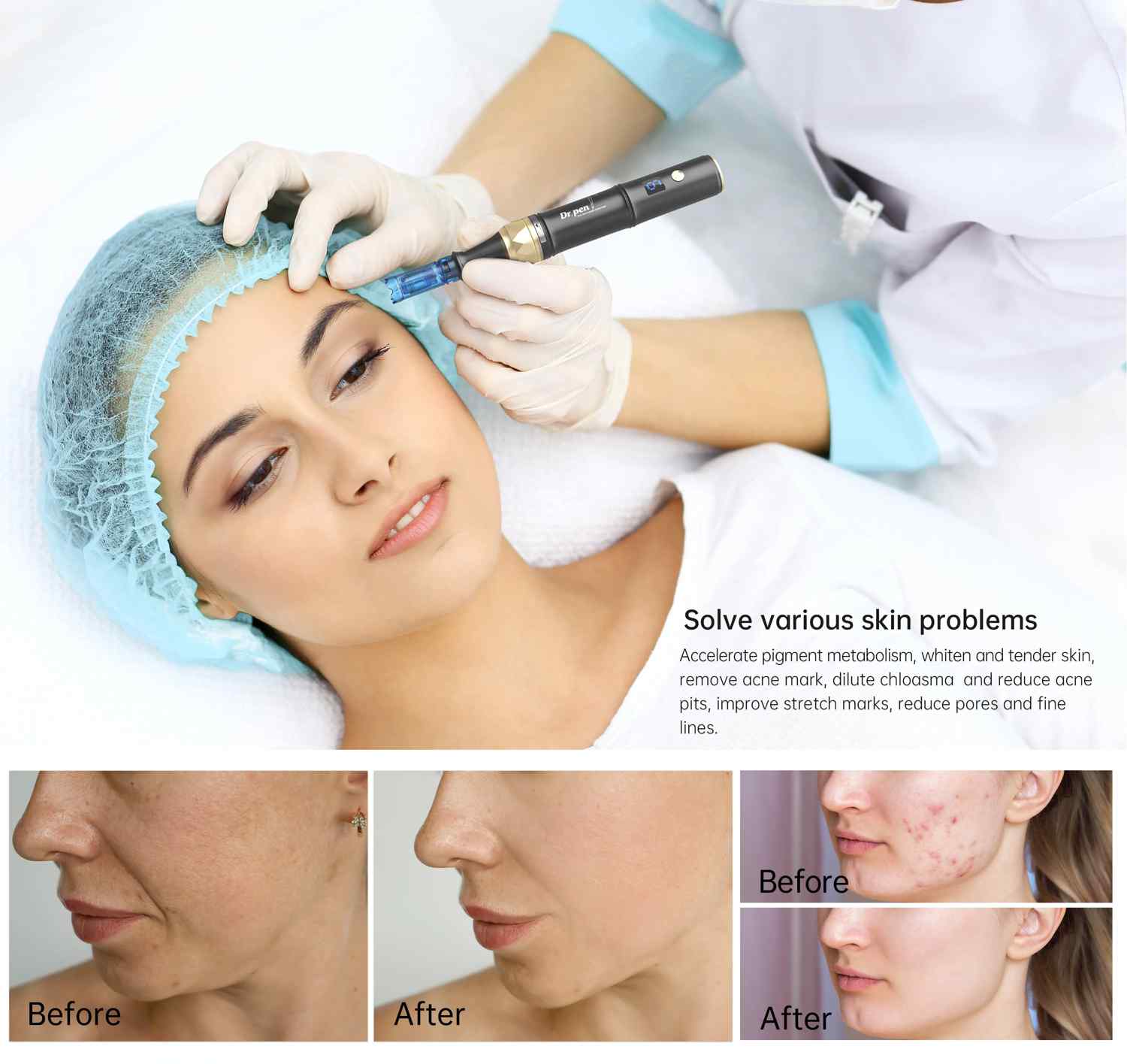 Dr. Pen A8S Microneedling Pen - Dr.Pen Authorized Distributor - Microneedling Pen
