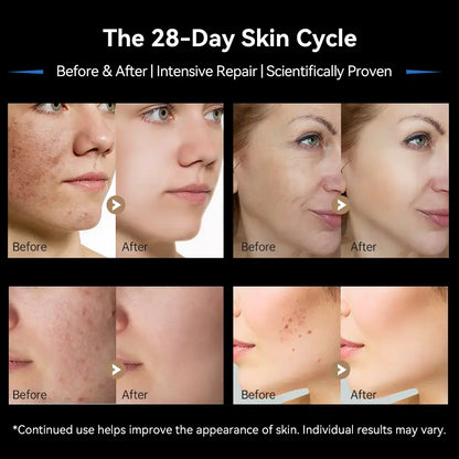 Dr. Pen M9 Microneedling Pen