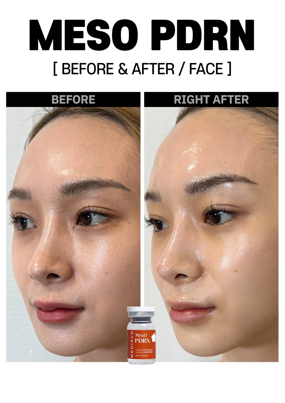 Medisco Meso PDRN - 5x3ml