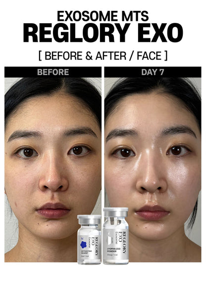Reglory Exo+ (Exosome) - 1x200mg+1x6ml