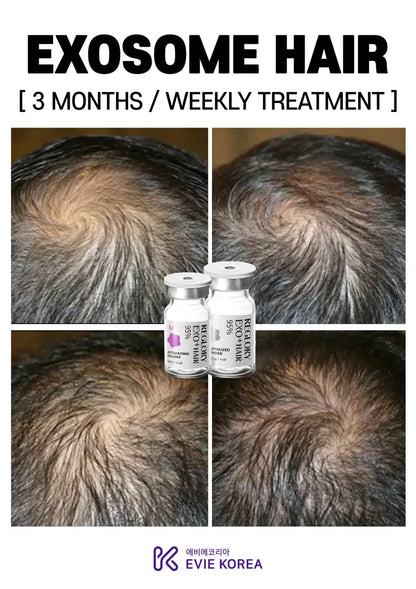 Reglory Exo+ Hair (Exosome) - 1x200mg+1x6ml